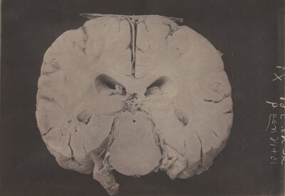 Cross-section of a Human Brain
